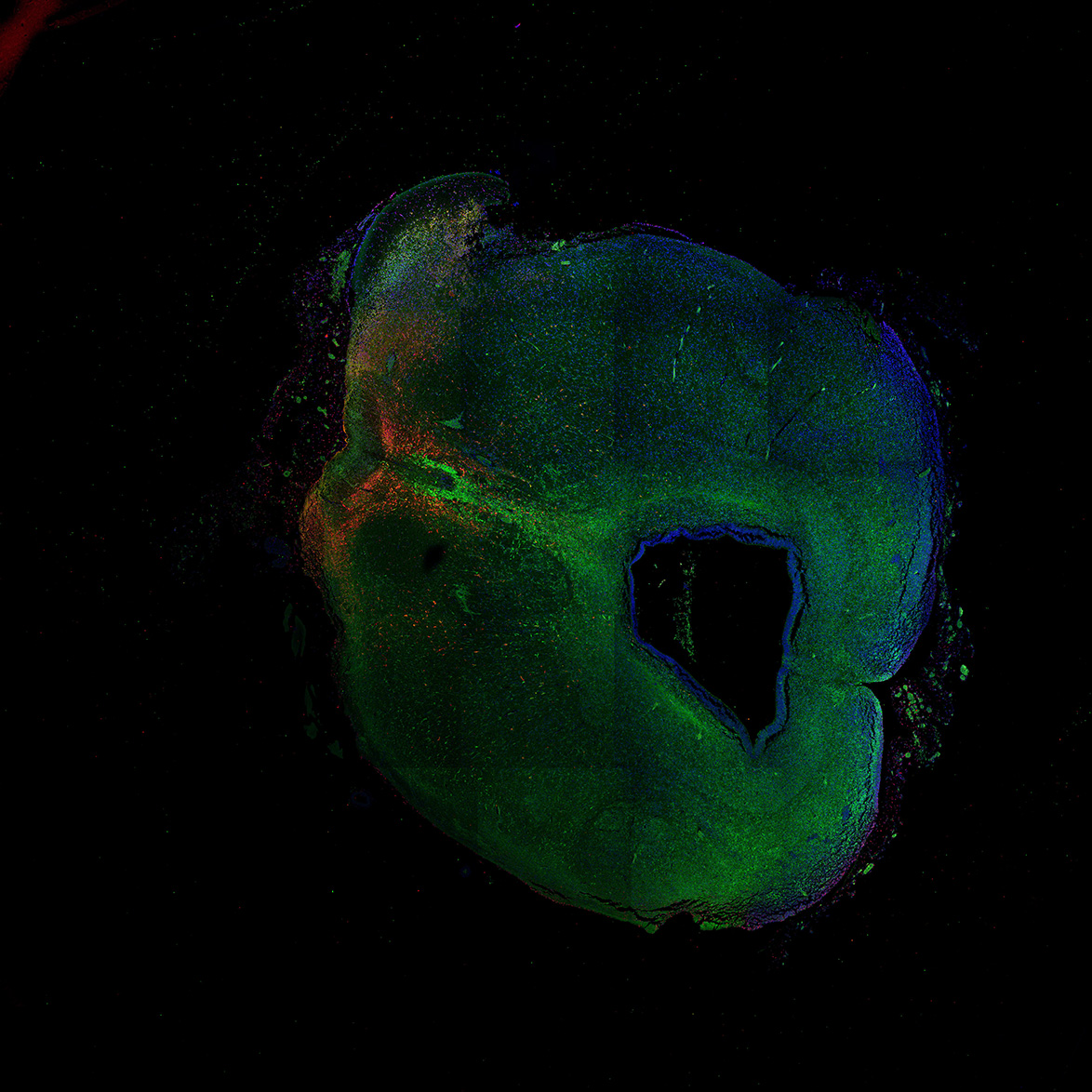 Human foetal midbrain